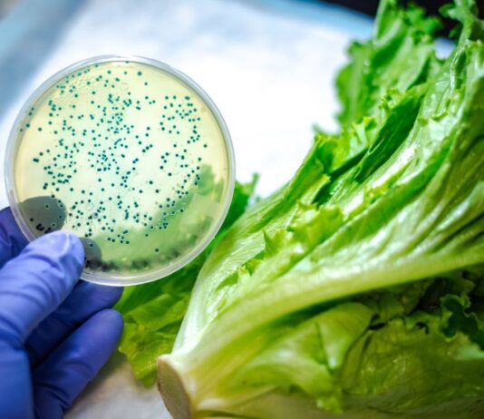 Día Mundial de la Salud: sanidad de cultivos impacta en la seguridad alimentaria Día Mundial de la Salud: sanidad de cultivos impacta en la seguridad alimentaria